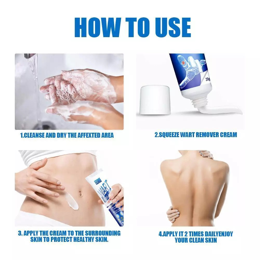 WartAway Herbal Removal Cream