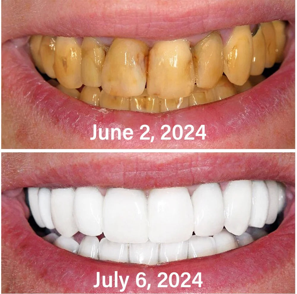 Ourlyard™ Tooth Powder